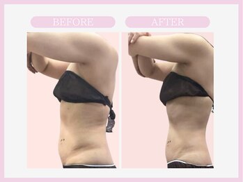 アコガレコガオ 秋田店/