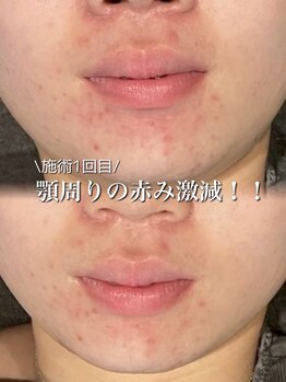 リイル バイ クレビア(REILE by Crebia)/お客様写真