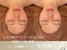 【エステ版ポテンツァ】ツヤハリ水光肌★スキンジェクション:HYALTIVE￥9,990