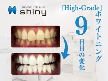 ホワイトニングサロン シャイニー 浜松細島店(shiny)/【超絶・美・白】ホワイトニング
