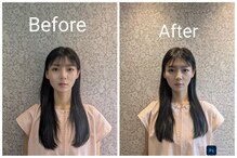 ソリーシェ鍼灸院(SORRISCE)