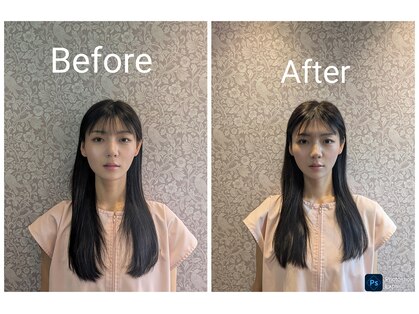 ソリーシェ鍼灸院(SORRISCE)の写真