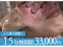 アリウム(ALLIUM)