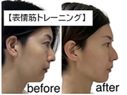 ベルプチグレン(belle petitgrain)の写真