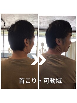 からだサロン サニー 堺東(SUNNY)/首こり・ストレートネック