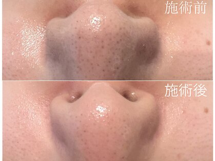 リッシュボーテ(RICHE BEAUTE)の写真