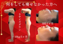 シェリートーキョー 成田店(Cherie Tokyo)