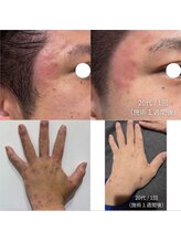 オニュ(onyu)/敏感肌、肌荒れの方にも！◎