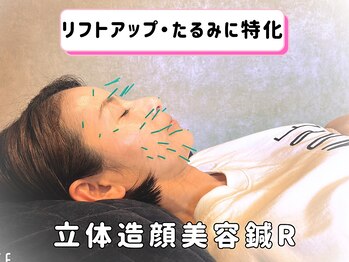 整骨院 えんの写真/【諫早市】美容鍼灸で徹底リフトアップ♪たるみ改善&ほうれい線をケアしてキュッと引き締まった小顔に◎