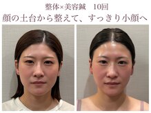 ナツメ鍼灸院(natume鍼灸院)の雰囲気（リラックスして施術が受けられる個室空間/女性専用）