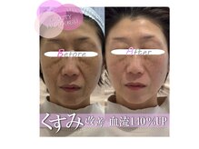 ディアメ(Diame)/血行促進＆肌トーンアップ！