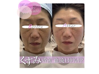 ディアメ(Diame)/血行促進＆肌トーンアップ！