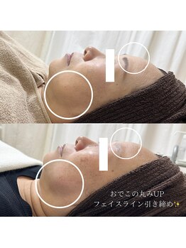 ラ フルール(La Fleur)/フェイス/オイルトリートメント