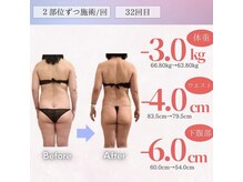 アフリオーラ はなみずき店(affriolant)/ビフォーアフター
