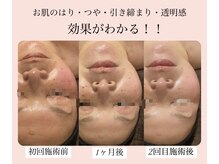 ディサイドロー(DECIDE L.A.W)/肌が若々しく！