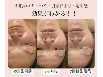 ディサイドロー(DECIDE L.A.W)/肌が若々しく！