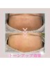 【女性限定】気になる部位フェイシャルワックス《2部位》¥3,980
