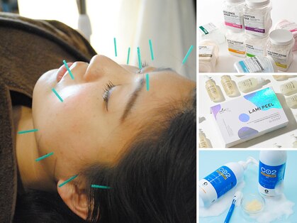 アキュリング(Aculing)の写真
