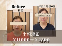 リボーン 福岡春日(Rebone)の雰囲気（テレビで紹介された大人気の《あごコリほぐし》ソフトな施術です）