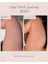 アパラギ(Aparagi)/【肌改善ボディハーブピーリング