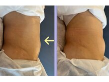 フェイシャル・ボディのマシーンメニューもあります★