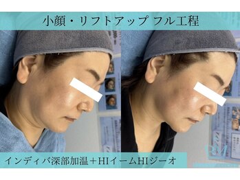 リメイク 広尾(REMAKE)/