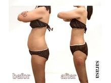 ナチュラル ビューティー スタイル さらさ(Natural Beauty Style)/さらさ痩身プログラム4カ月後