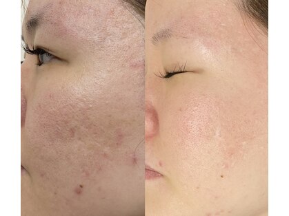 カナエル ビューティーサロン(Canael Beauty salon)の写真