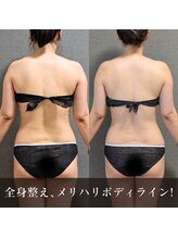 バンブー(bamboo)/姿勢整う、メリハリボディー
