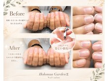 ホロムアガーデン 芝(Holomua Garden)の雰囲気（ガチガチ爪周り,二枚爪,縦線等お悩み解消へ！自爪育成,美爪育成）