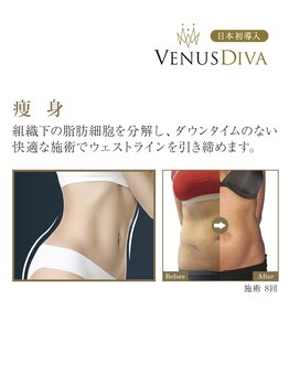 ラナクラニ/Veuns Diva 日本初導入