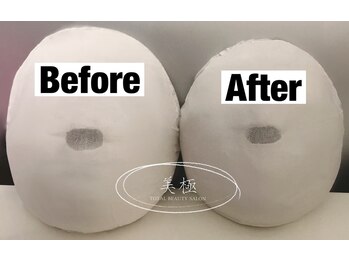 美極 銀座店/銀座/小顔コルギ/小顔矯正