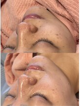 ヴィーナス(Venus)/白玉スキンプレミアム