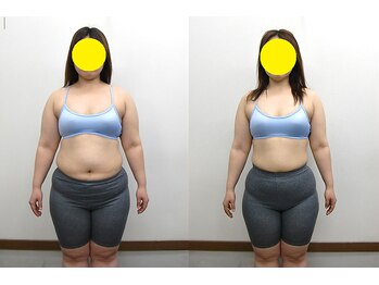 宮崎整体院/【ダイエットコース】