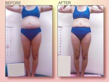 ジュリア オージェ 京橋店/ ビフォーアフター（脂肪燃焼）