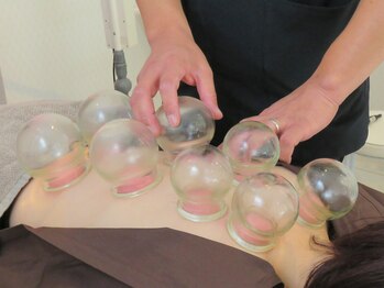 いこい鍼灸院 整骨院 小倉院/吸い玉・カッピング