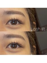 カロン(Kalon)/ラッシュリフト