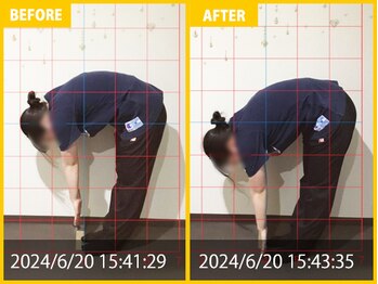 整体院 元 くまなん店/下肢の倦怠感で来院されました