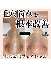 ルネッタ(Lunetta)/