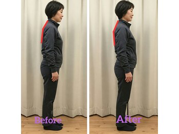 なごやの森/姿勢矯正ビフォーアフター