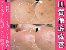 ハス(hasu.)/シミ緩和♪くすみOFF！