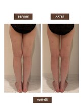 ファミーユ 新宿店/【夏前に脚のケア！】