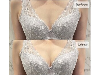 ヴィノ(VINNO)/瞬時にケア♪