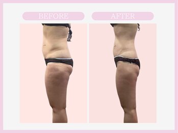 アコガレコガオ 秋田店/