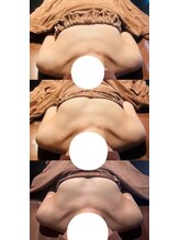 ロココ 豊田店(Rococo)/ビフォーアフター