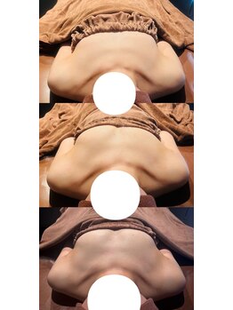 ロココ 豊田店(Rococo)/ビフォーアフター