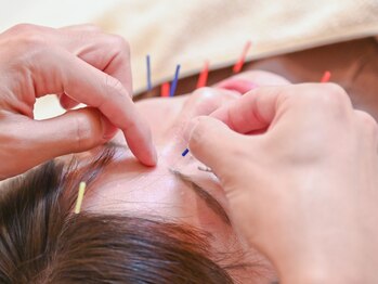 すばる屋の写真/【全身鍼灸＋美容鍼灸￥7700】全身の巡りケアと美容鍼で施術後、目がパッチリ爽快な視界に感動間違いなし！