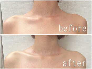 美人ヶ丘 長野店/小顔矯正,マッサージ,ヘッドスパ