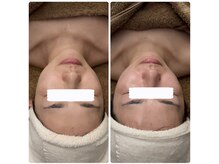 メナードフェイシャルサロン 本通り/