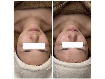 メナードフェイシャルサロン 本通り/